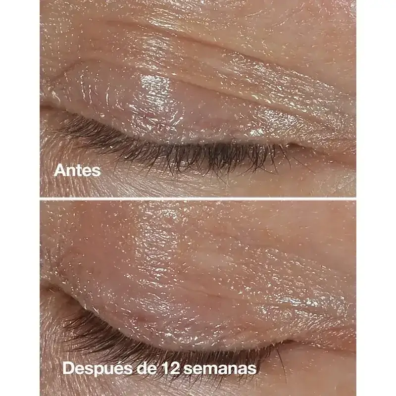 Clinique Smart Clinical Repair Crème anti-rides pour les yeux, 2x15 ml - Image 3