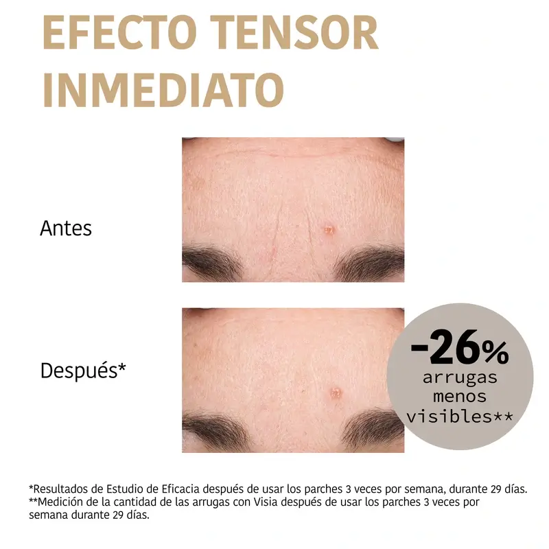 Iroha Nature Forehead Patches 99% Collagen (3 pcs + 1 Mist) , 3 paires - Image 4